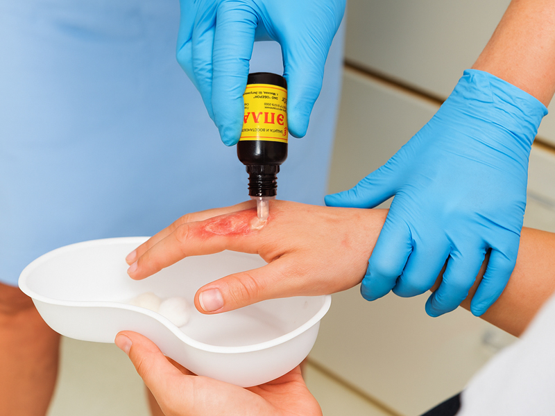 Препарат Эплан - Лечение химических ожогов от бытовых чистящих средств