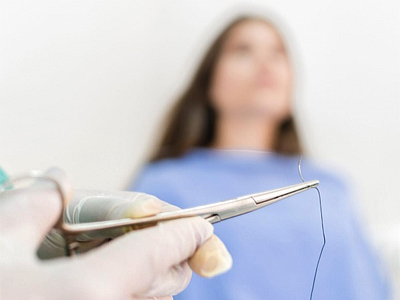 ЭПЛАН после операции для ускоренного заживления швов